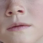 Naparovanie na uvolnenie dychacich ciest
