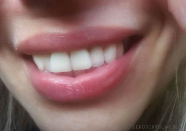 tipy na bielenie zubov